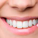 Gummy Smile