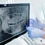 Digital X-ray