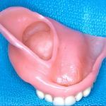 Maxillofacial
