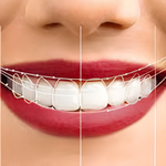 Smile Test Drive