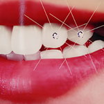 Dental Jewellery
