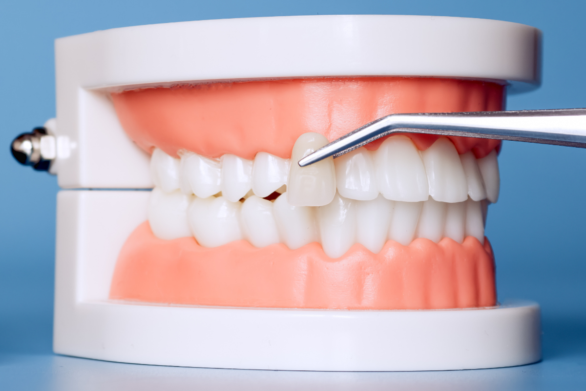 Flawless Cosmetic Smile Portfolio
