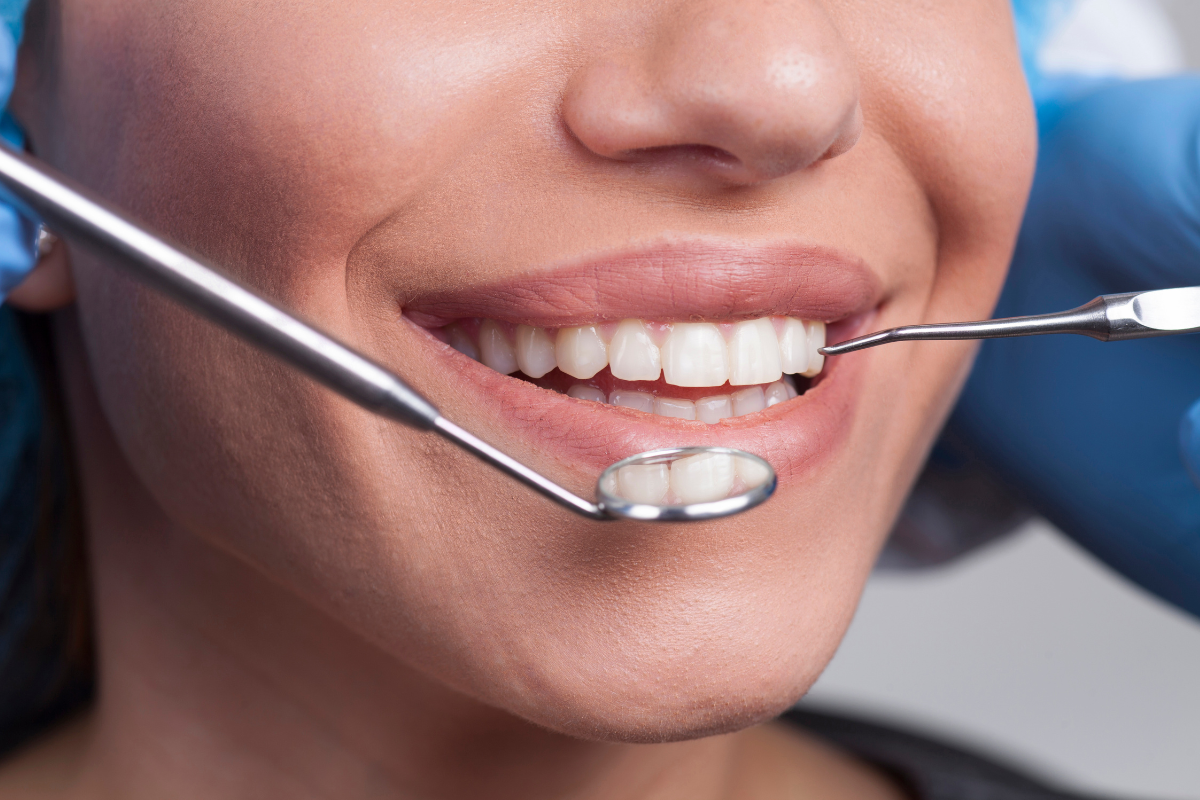 Full Mouth Rehabilitation at Dental Dynasty