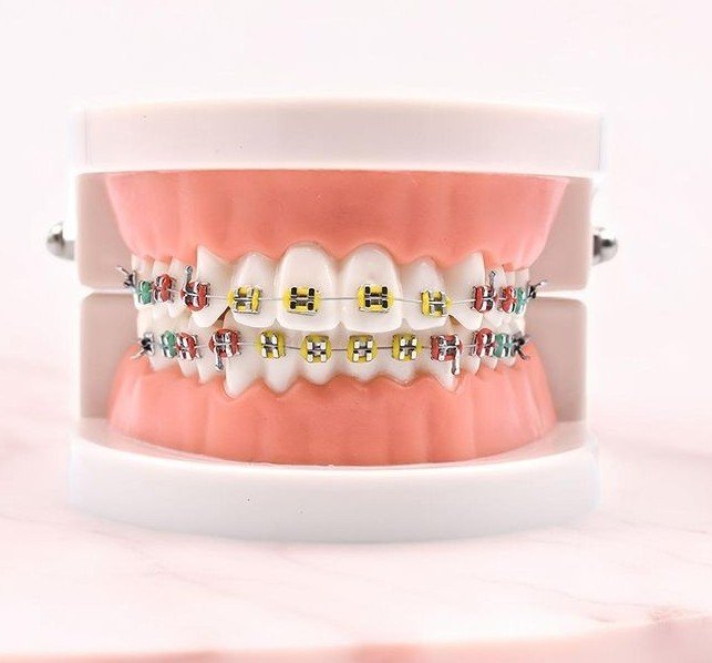 Aesthetic dental braces